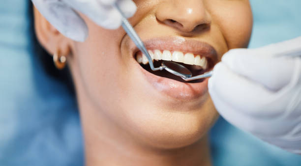 Best Emergency Denture Repair in Channel Lake, IL